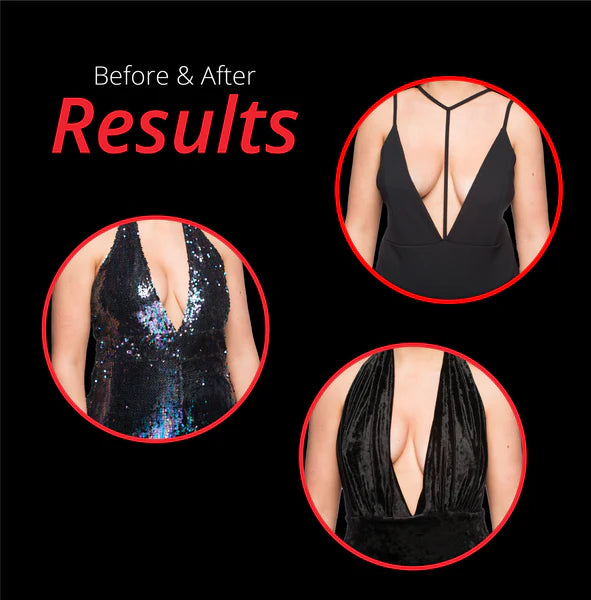 Perkys Breast Lift Tape A-C Results