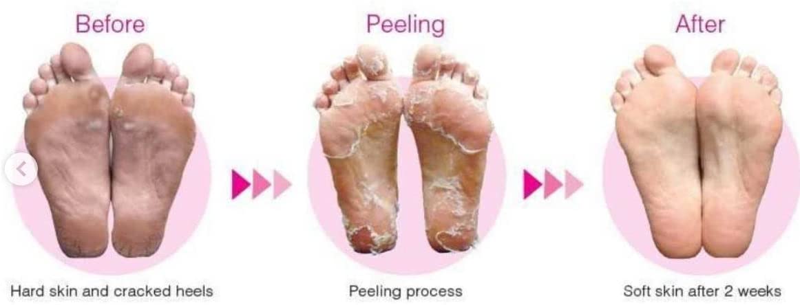 Bathefex Softsole Exfoliating Foot Peel